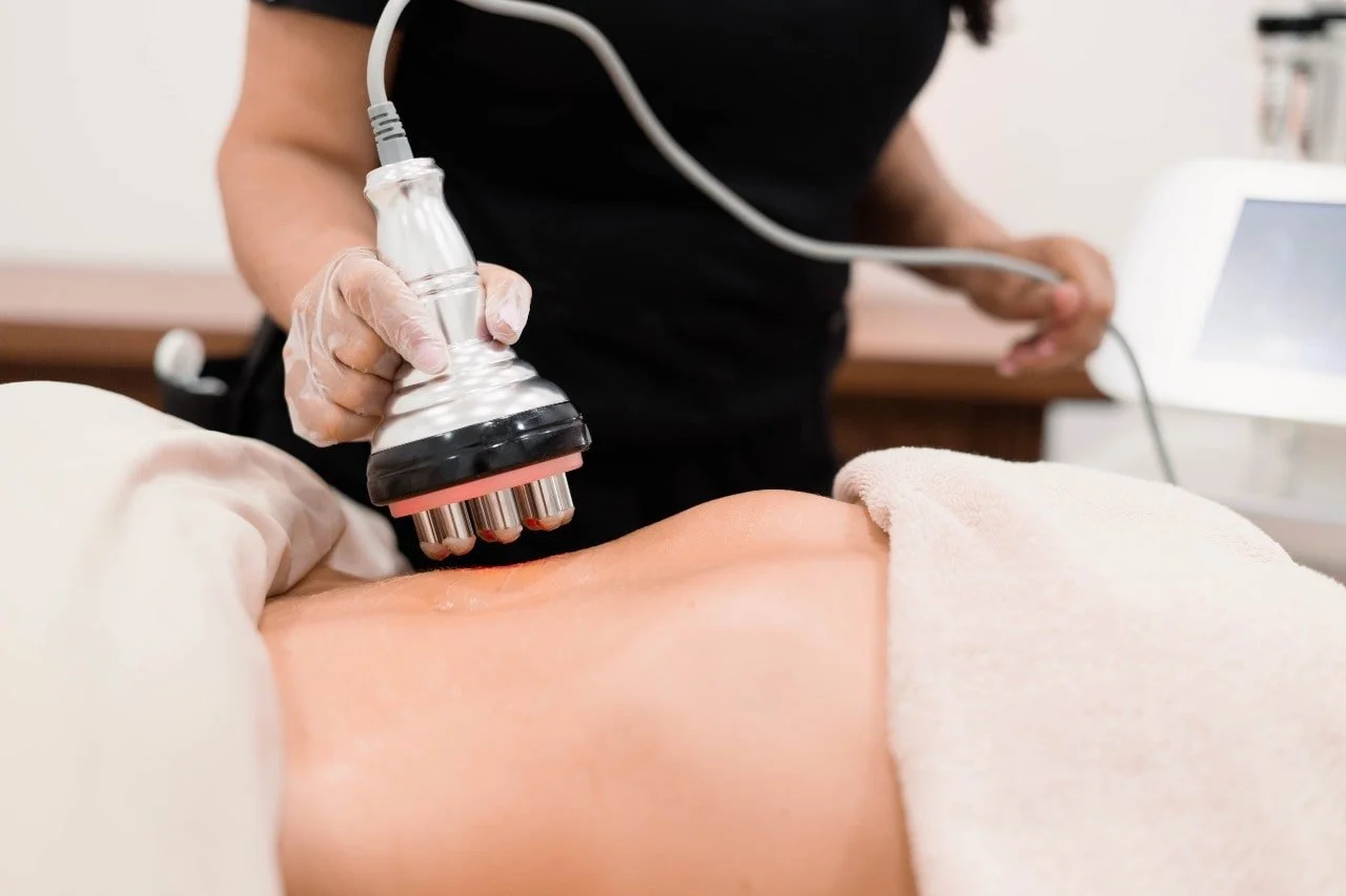 Radiofrequency and cavitation body sculpting treatment in progress