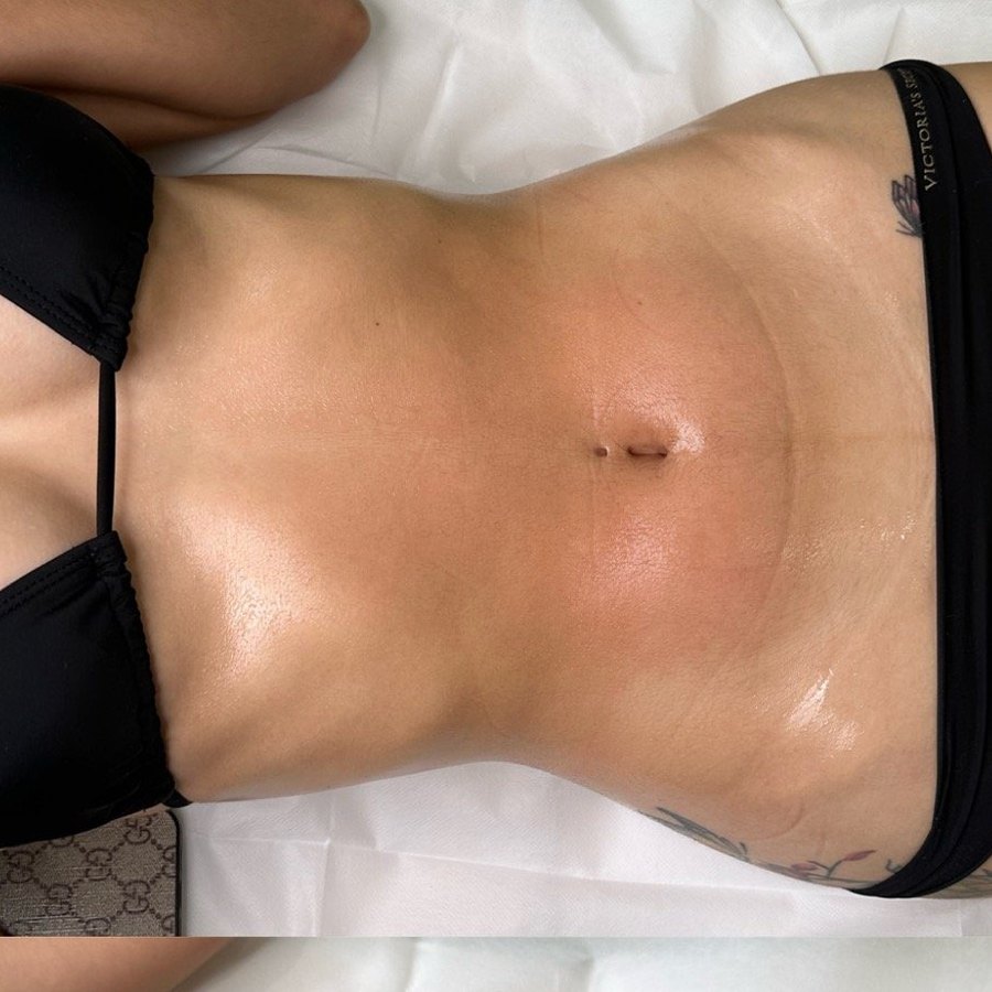 Toned midsection, real client result